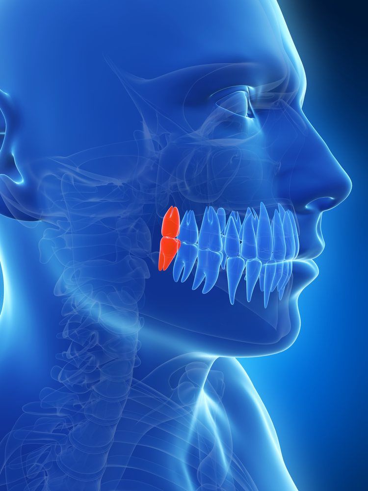 Wisdom Teeth Removal - Stonebridge DentalMcKinney, TX ...